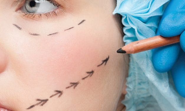Making Plastic  Surgery Work for You